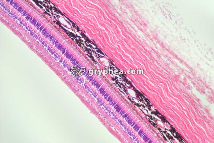 Rétine et paroi de l'oeil CT x40 - gryphea.org
